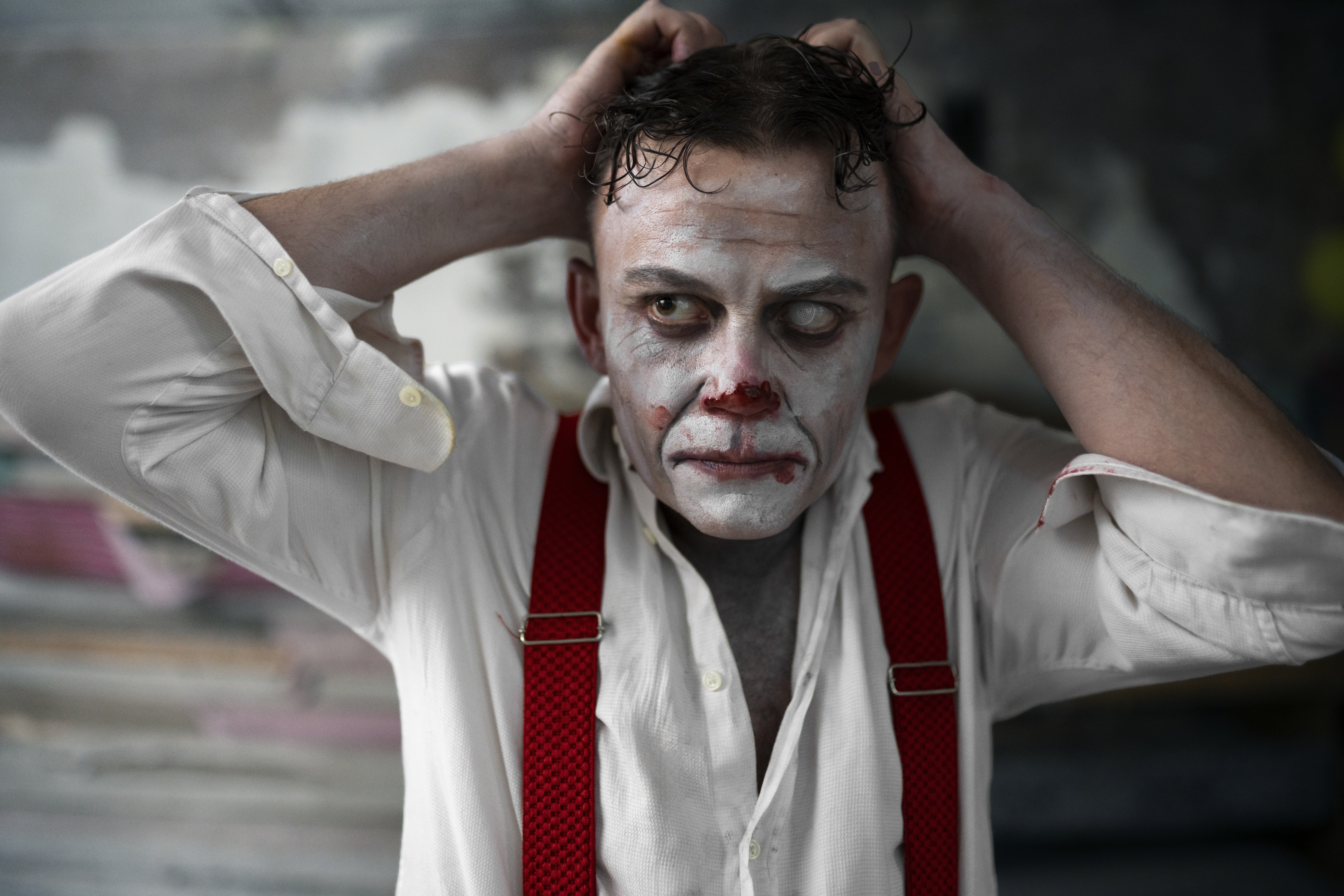 اضطراب ثنائي القطب من النوع الثاني